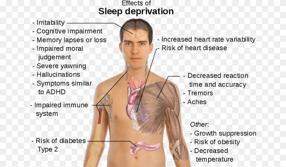 This Guide Gets At The Link Between Anxiety And Sleep Organs In The Body Female, Adult, Person, Woman, Skin Free Png