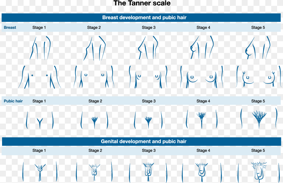 This Picture Depicts The Stages Of Pubic Hair Genital Tanner Scale Pubic Hair, Text, Person Free Png