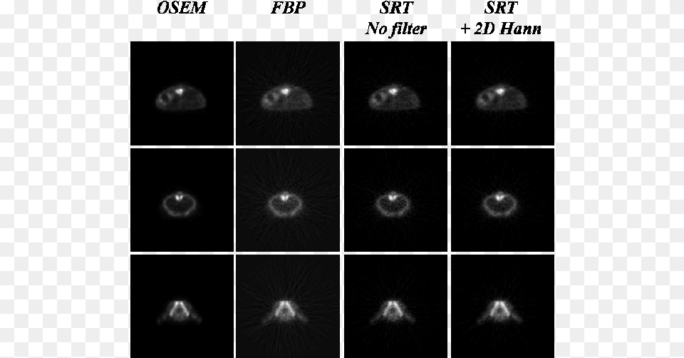 Three Different Slices Of An Fdg Mouse Scan Acquired Moon, Flare, Light, Lighting, Nature Free Png Download