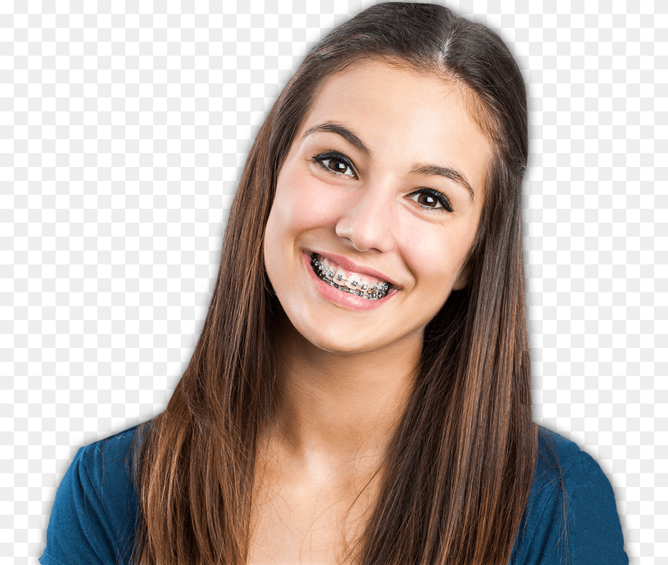 Thumb Image Braces Smile, Adult, Teeth, Person, Mouth Free Png