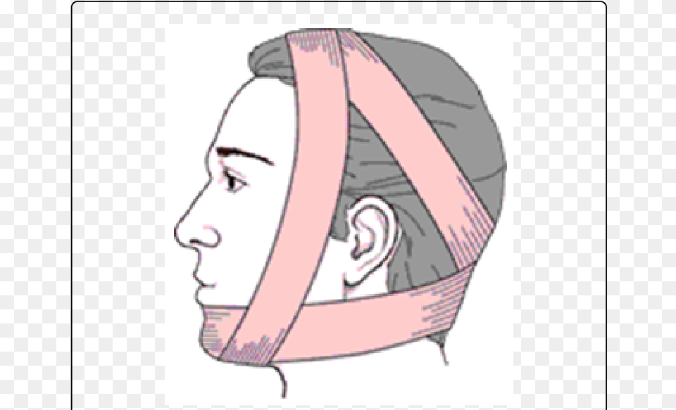 Tmj Dislocation Bandage, Accessories, Face, Head, Person Png