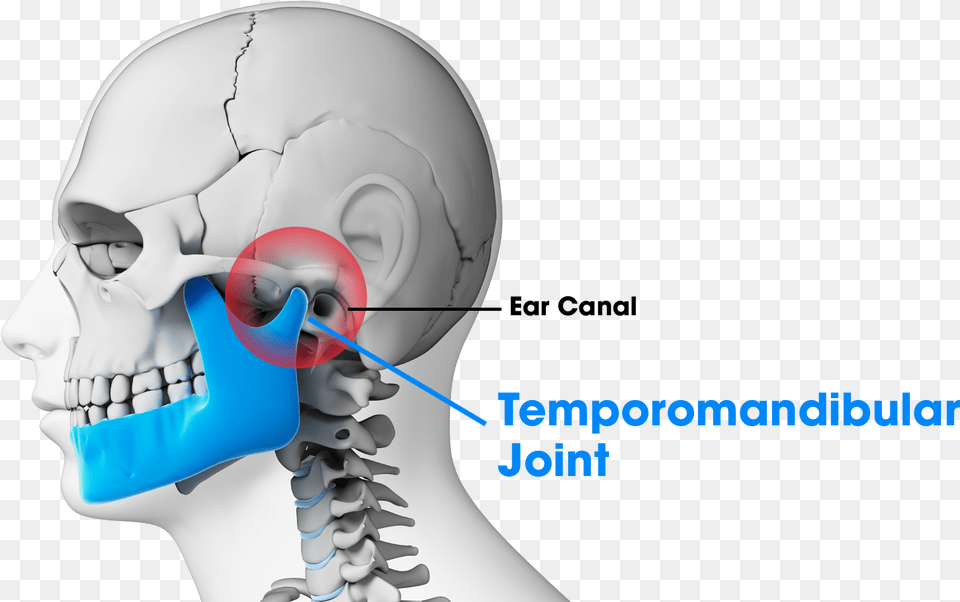 Tmj Treatment Denver Broken Human Jaw Bone, Head, Person, Face, Adult Free Transparent Png