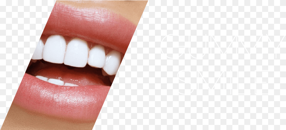 Tongue, Body Part, Mouth, Person, Teeth Free Transparent Png