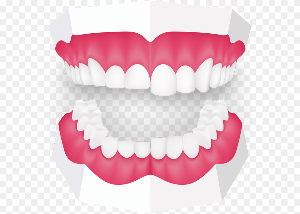 Tooth Grinding Toothbeary Mouth Guard Clipart, Body Part, Person, Teeth, Face Free Png Download