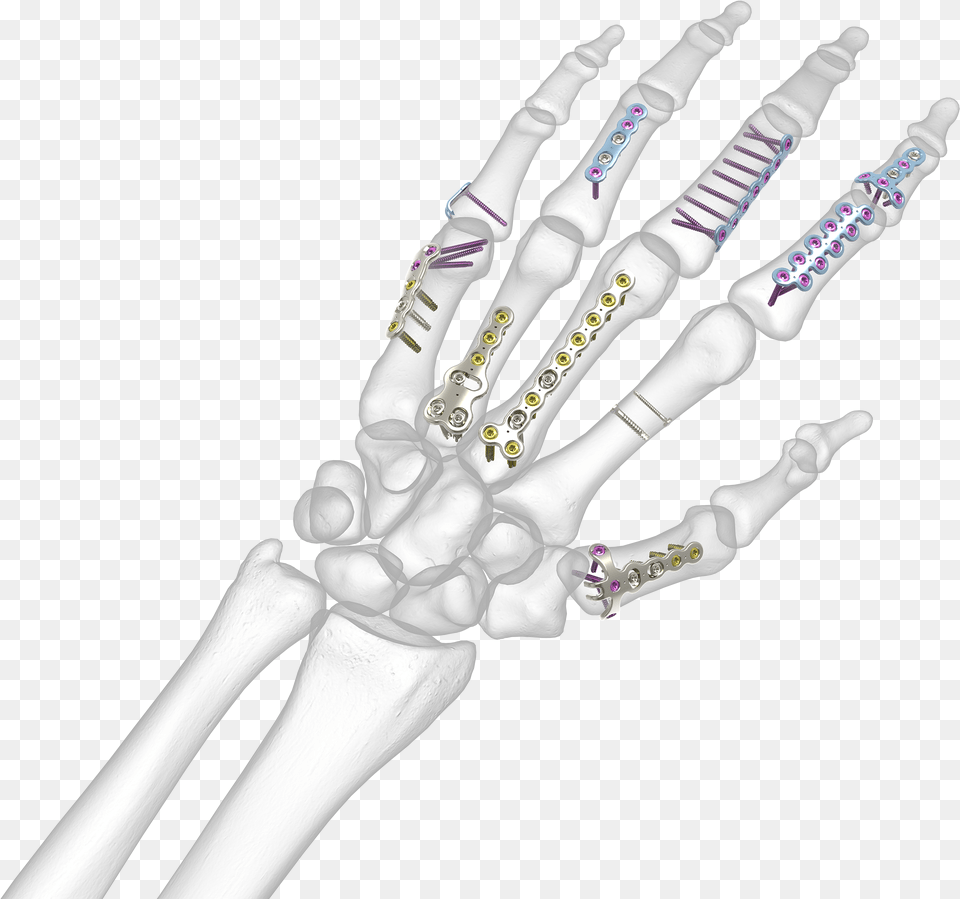Bone Hand, Blade, Dagger, Knife, Person Free Transparent Png