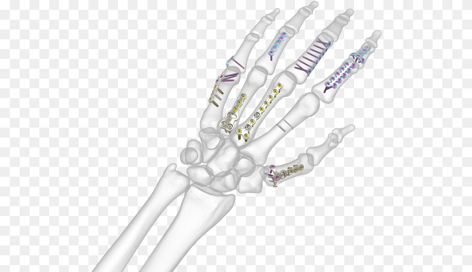 Transparent Bone Hand Png Image