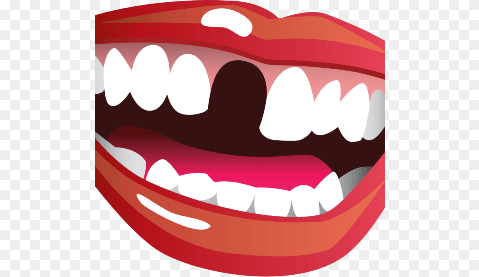 Transparent Brush Teeth Clipart Missing Teeth Clipart, Body Part, Mouth, Person Png