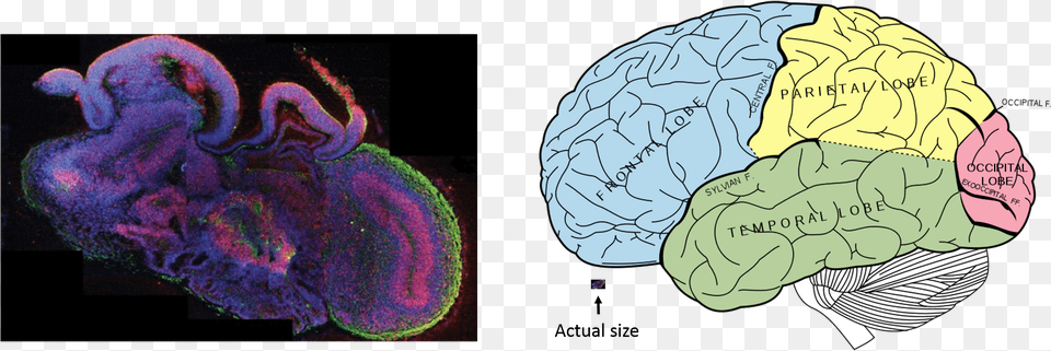 Transparent Human Brain Clipart Mini Brains, Ct Scan, Face, Head, Person Png Image