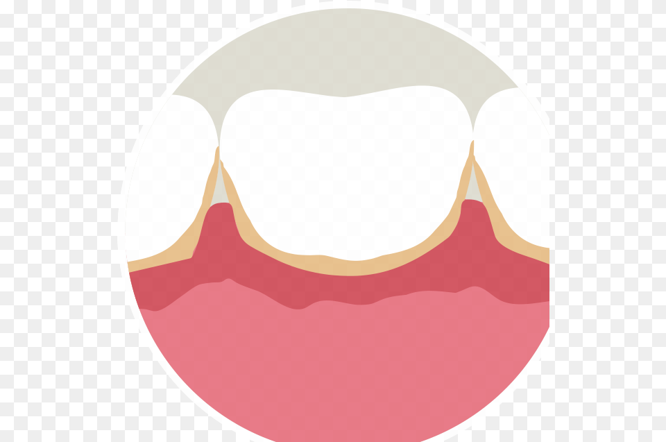 Transparent Mouth Blood Bleeding Gums Clipart Transparent, Body Part, Person, Teeth Free Png Download