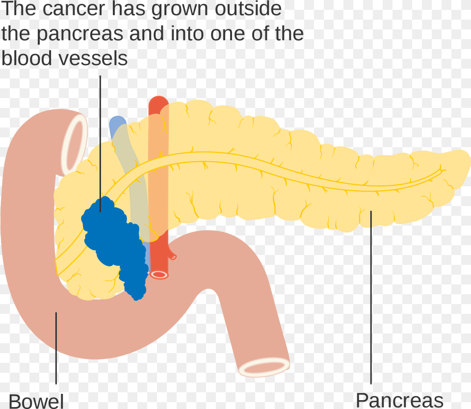 Transparent Pancreas Illustration Free Png Download