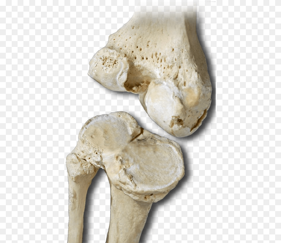 Transparent Real Bone, Ct Scan, Fungus, Plant, Person Png