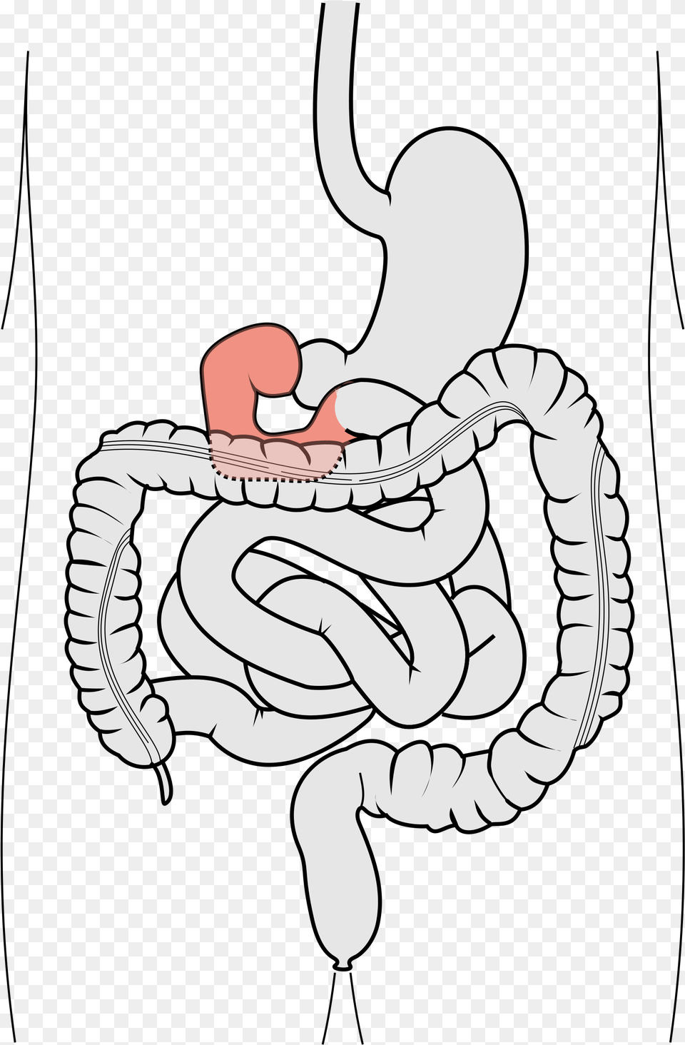 Transparent Small Intestine 12 Fingertarmen, Knot, Baby, Person Png Image