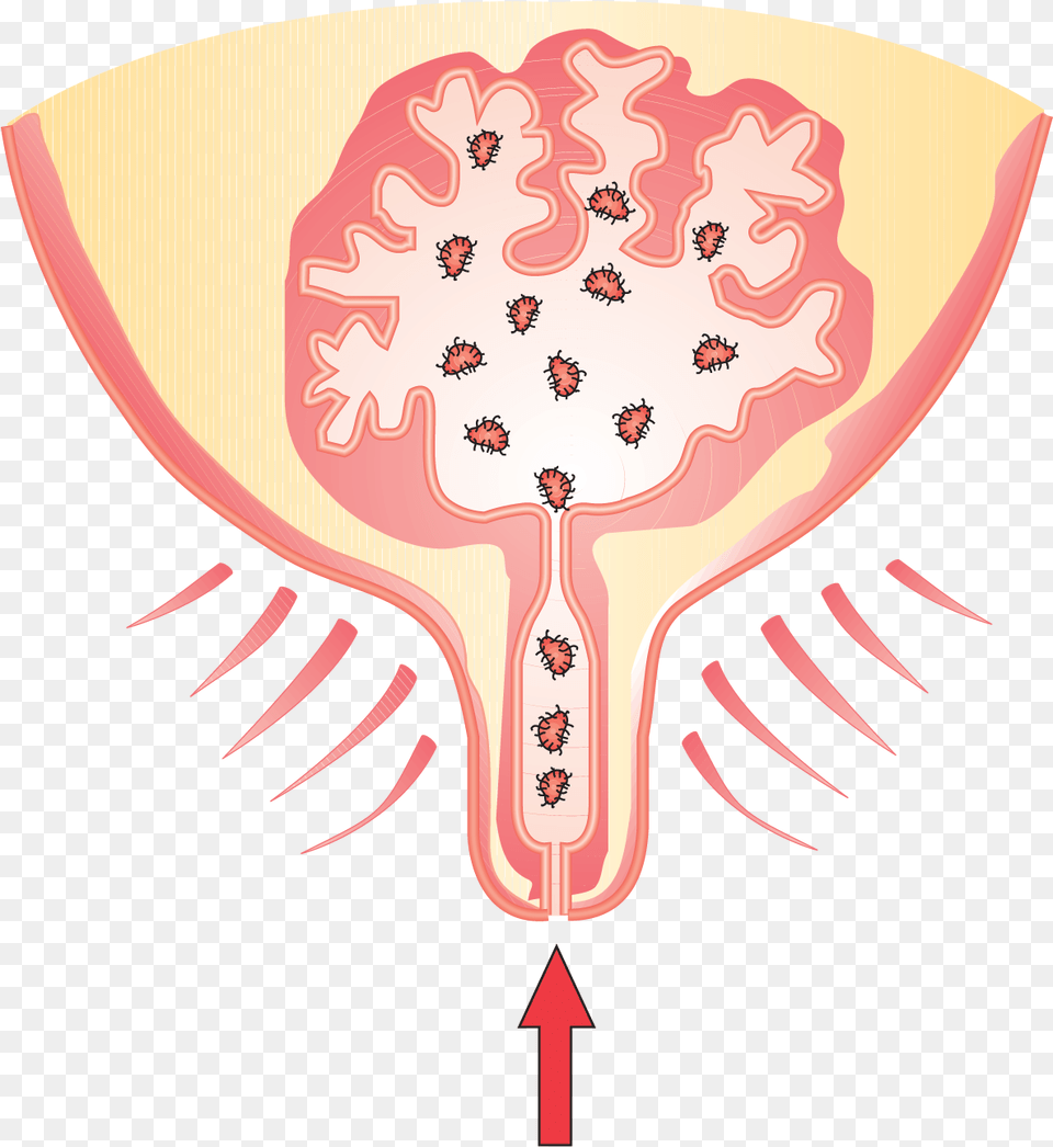 Transparent Soil Clipart Mastitis In Cow Cartoon, Body Part, Face, Head, Neck Png