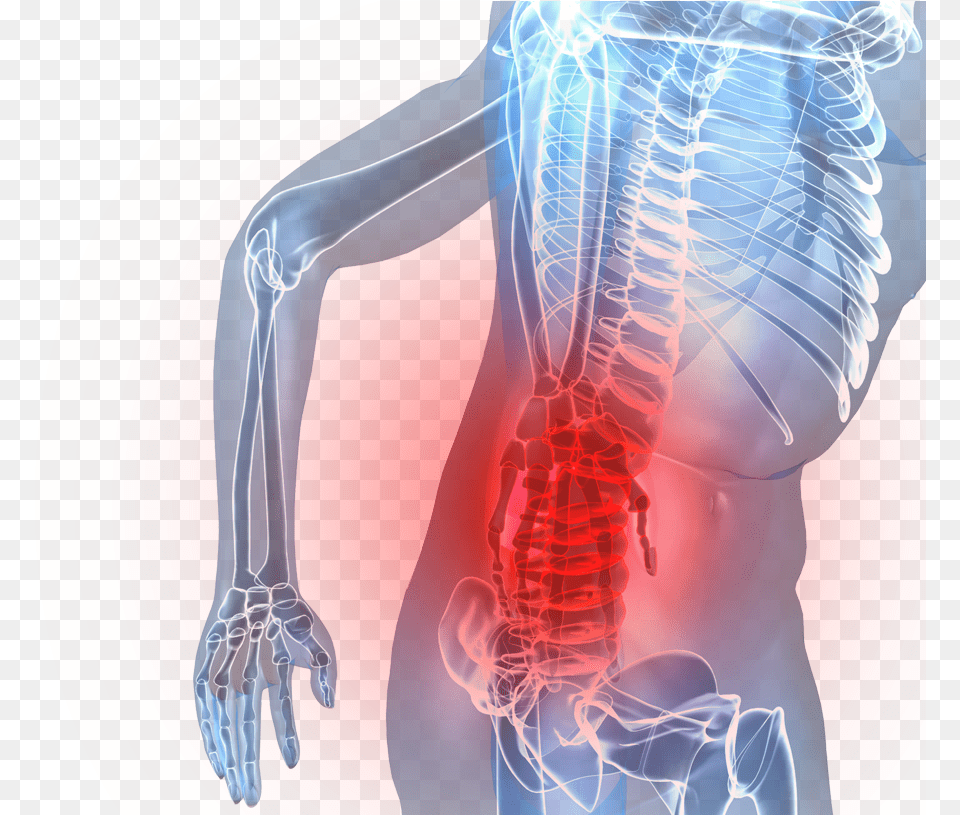 Transparent Spinal Cord Low Back Pain, Adult, Female, Person, Woman Free Png