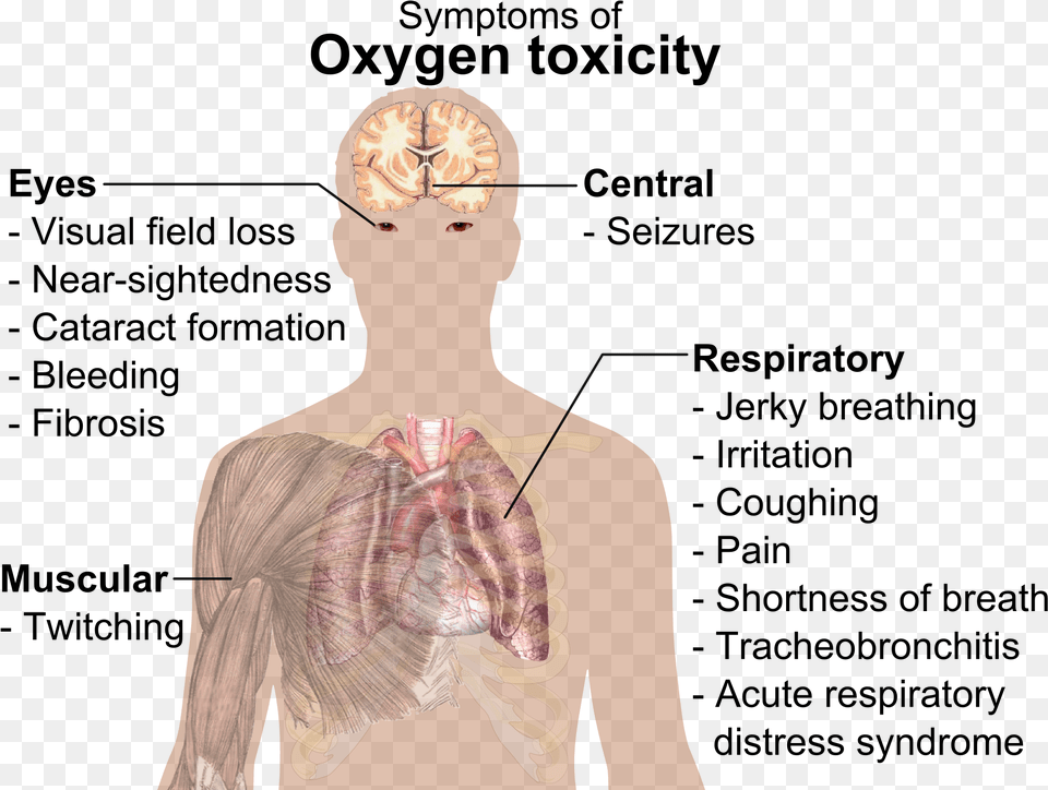 Transparent Symptoms Sign And Symptom Of Oxygen Toxicity, Adult, Female, Person, Woman Free Png