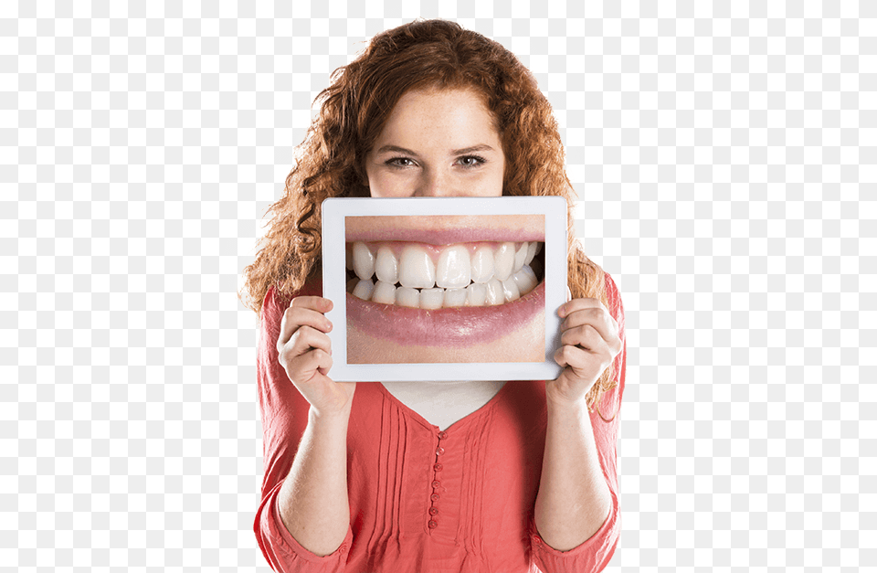 Transparent Teeth Smile Orthodontic Patients, Body Part, Face, Head, Mouth Png Image