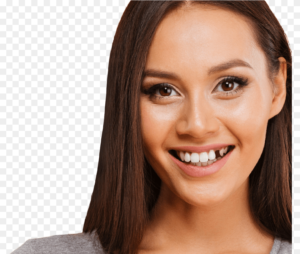 Transparent Teeth Smile Woman Missing Front Teeth, Person, Dimples, Face, Happy Png