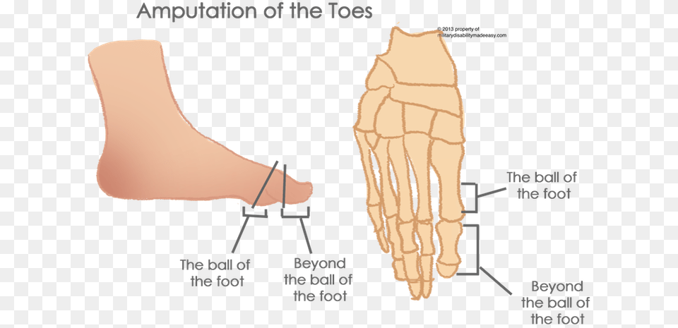 Transparent Toes Partial Amputation Of Toe, Ankle, Body Part, Person, Massage Free Png Download