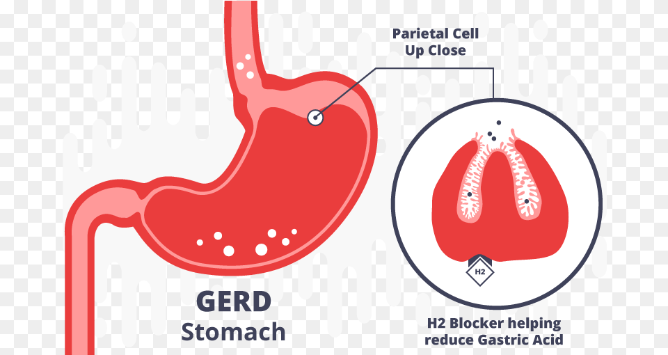 Triple J, Body Part, Stomach Free Transparent Png