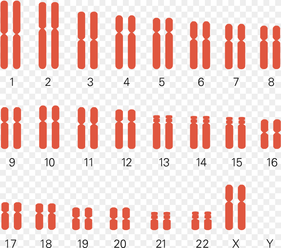 Turner Syndrome Karyotype Chart Cariotipo Del Sindrome Dela Supermujer, Text, Scoreboard, Number, Symbol Free Png