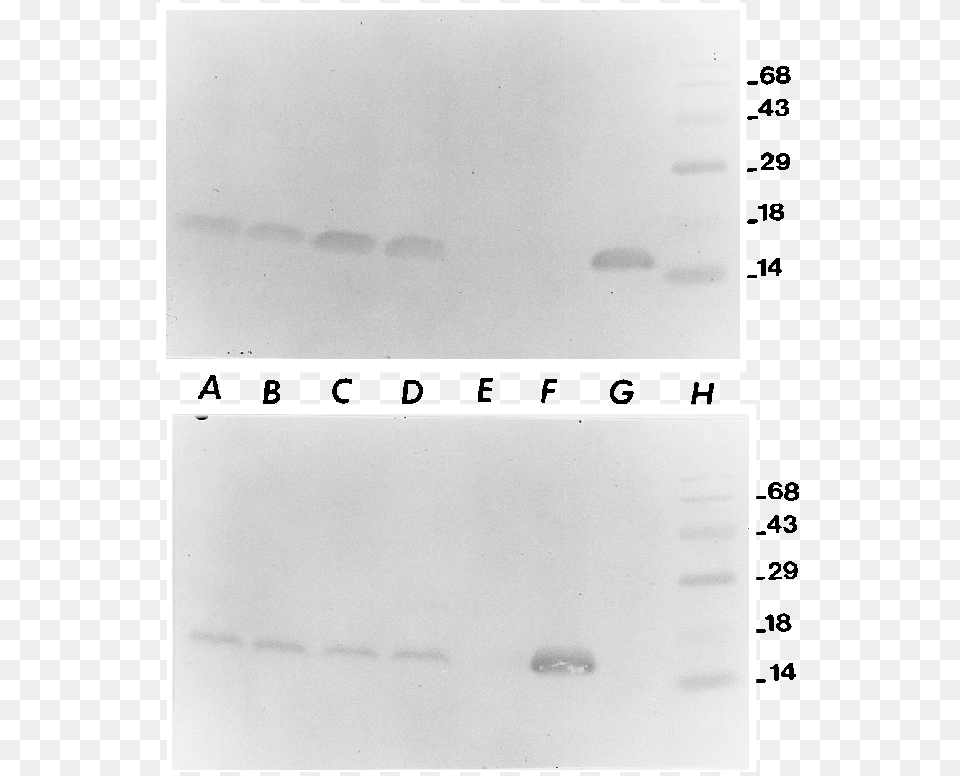 Two Identical Sds Polyacrylamide Gels Were Electrophoresed, White Board, Text Free Png Download