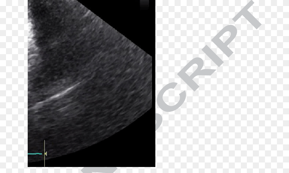 Two Masses Are Seen Here One In The Tv And One In Laser Ablation In Liquid, Nature, Night, Outdoors, Astronomy Png