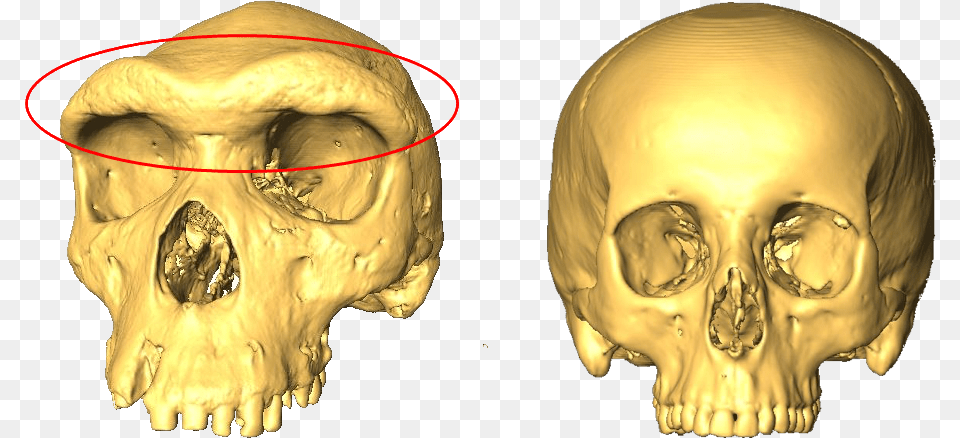 Two Skulls One With A Larger Eyebrow Ridge Skull Brow Ridge, Baby, Person, Head, Ct Scan Free Png Download