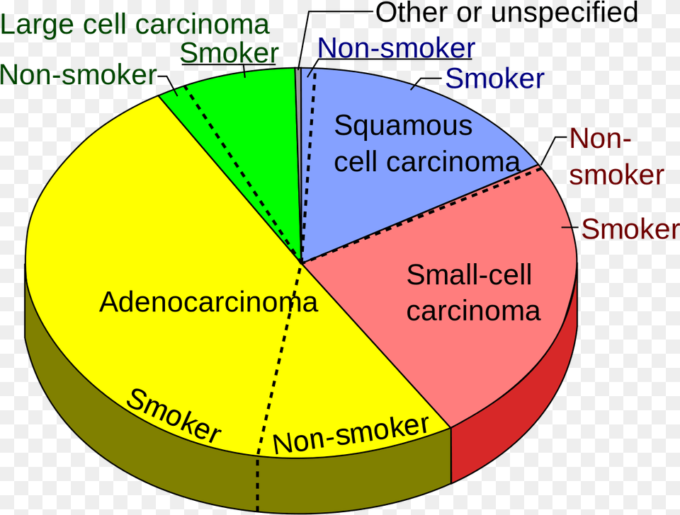 Types Non Small Cell Lung Cancer Lung Cancer Pie Chart, Pie Chart, Disk Png Image