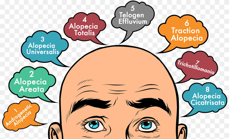 Types Of Hair Loss You Must Learn About Man With Bald Hair Cartoon, Book, Head, Person, Publication Png Image