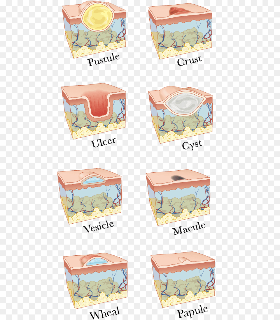 Types Of Skin Lesions, Paper, Box, Towel Free Transparent Png