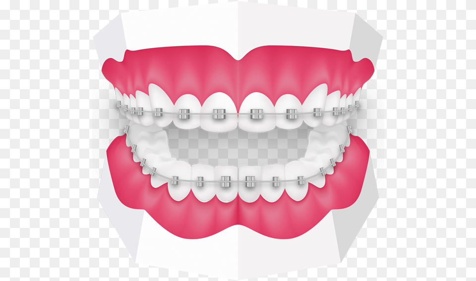 Uk Tooth, Body Part, Mouth, Person, Teeth Free Png Download
