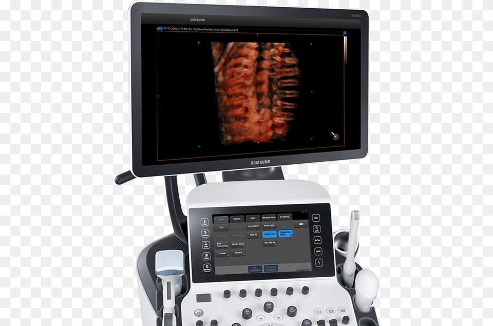 Ultrasound System Ws80a With Elite Samsung Ws 80 A Elite, Computer Hardware, Electronics, Hardware, Monitor Png