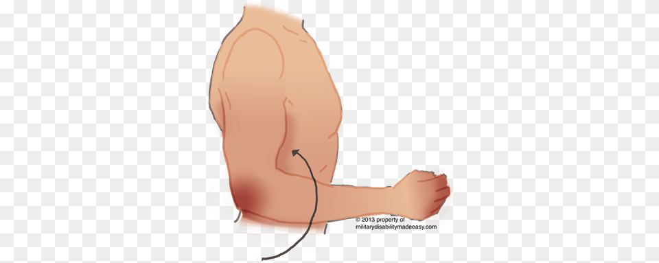 Upper Nerve 29 Damage Of Musculocutaneous Nerve, Body Part, Finger, Hand, Person Png