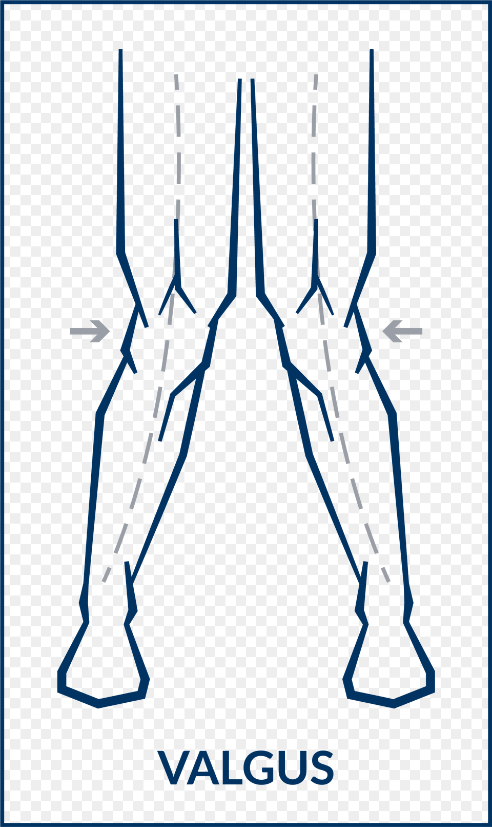 Use The Allen Wrench Provided For Minor Varusvalgus Art, Chart, Plot Png Image
