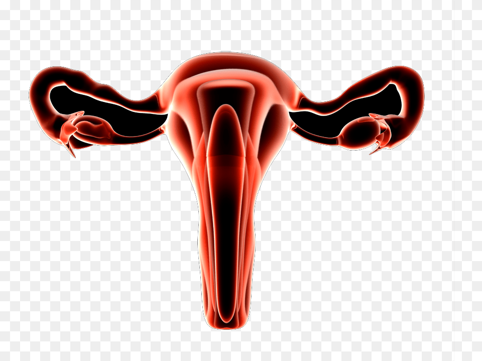 Uterine Fibroids Adenomyosis Illustration, Smoke Pipe Free Png