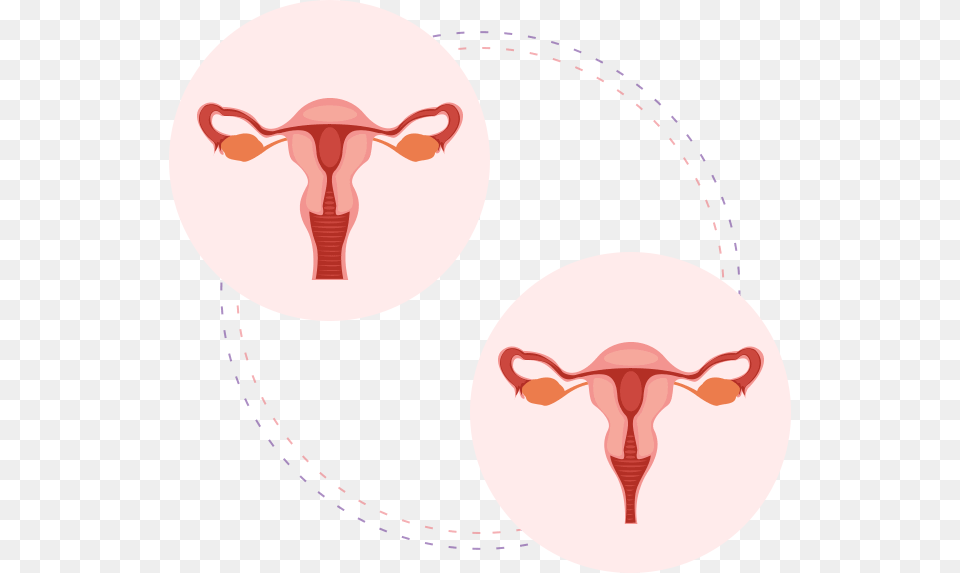 Vaginal Laxity Labelled Female Reproductive System Diagram Simple, Person, Face, Head, Ct Scan Png