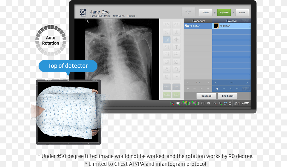 Value Up Package 2021 Samsung Healthcare Global, Ct Scan, Screen, Electronics, Computer Hardware Free Png Download