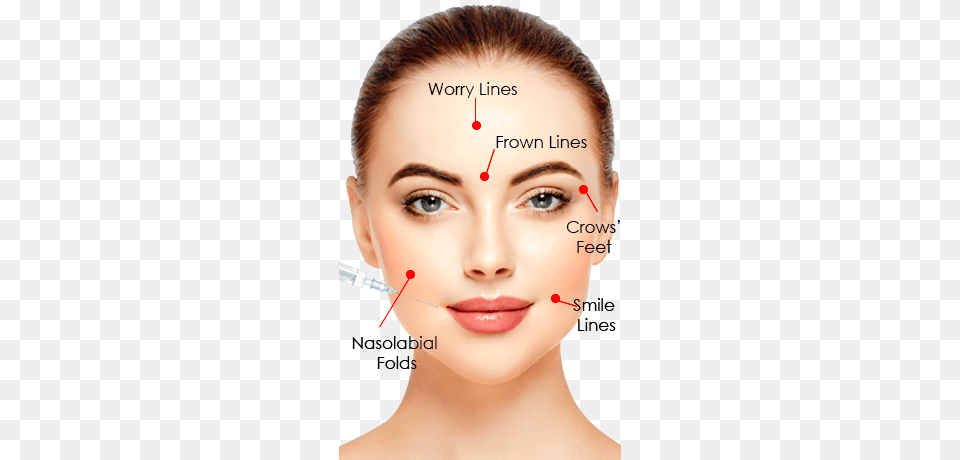 Vampire Facial Anti Wrinkle Injection Sites, Adult, Face, Female, Head Free Transparent Png