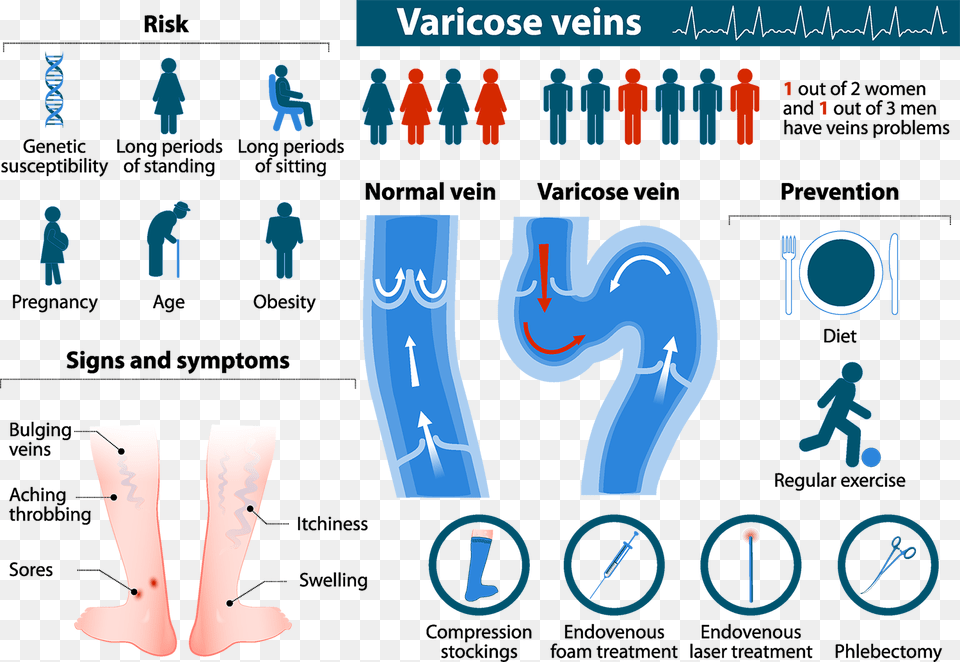 Varicose Veins Infographic Web Risk Factor Of Varicose Vein Free Transparent Png