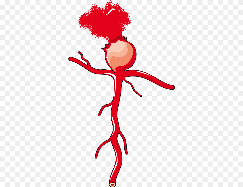 Vasodilation, Stain, Baby, Person Png Image