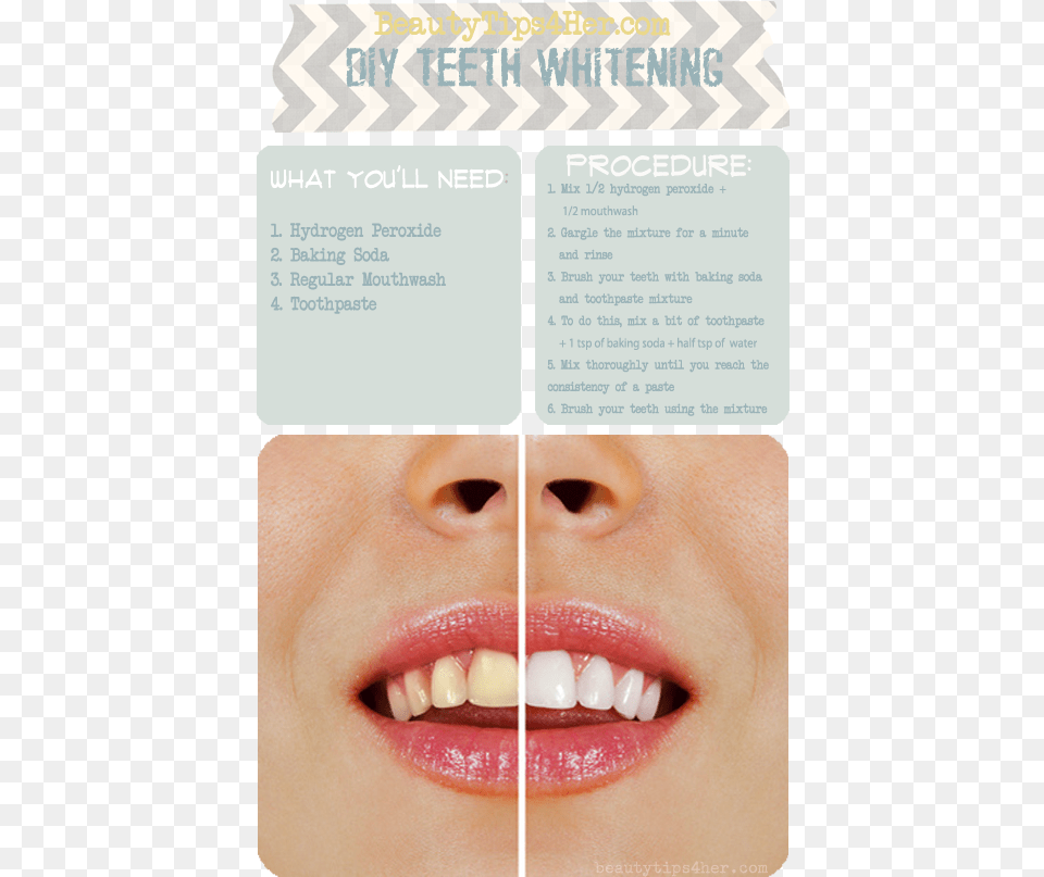 Ways To Make Ur Teeth Straight, Body Part, Mouth, Person, Baby Free Png