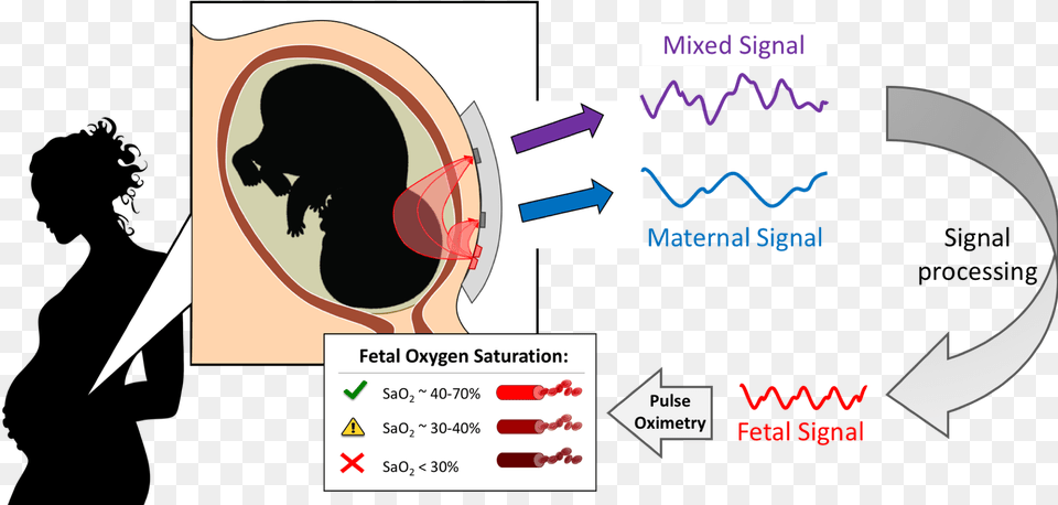 We Are Developing A Non Invasive Transabdominal Fetal Diagram, Ct Scan, Animal, Bear, Mammal Png