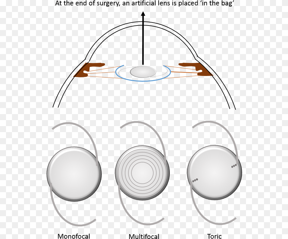 What Are Intraocular Lens, Indoors, Kitchen, Cooktop, Lighting Free Png Download