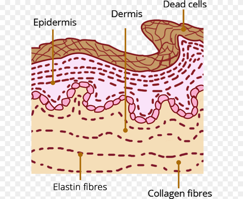 What Causes Bruises Diagram Free Png Download