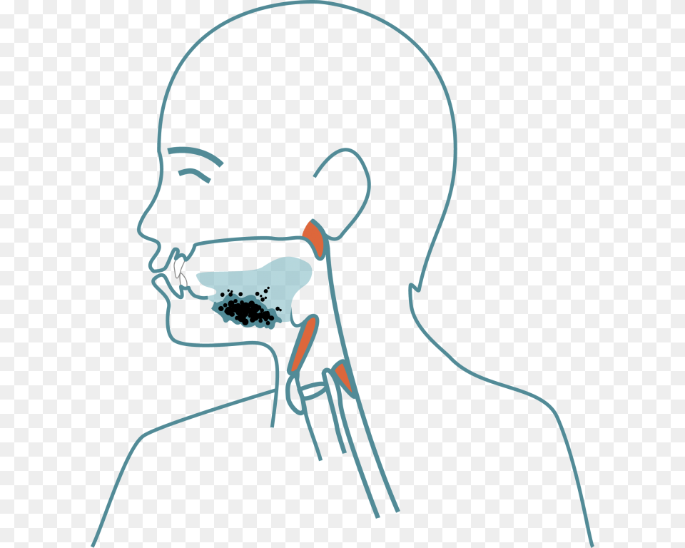 What Is Dysphagia Symptoms Afl Football Field Template, Face, Head, Person, Body Part Png Image