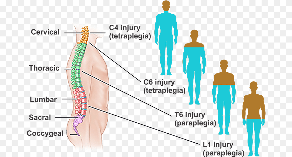 What Is Spinal Cord Injury C7 Spinal Cord Injury, Plot, Person, Chart, People Png