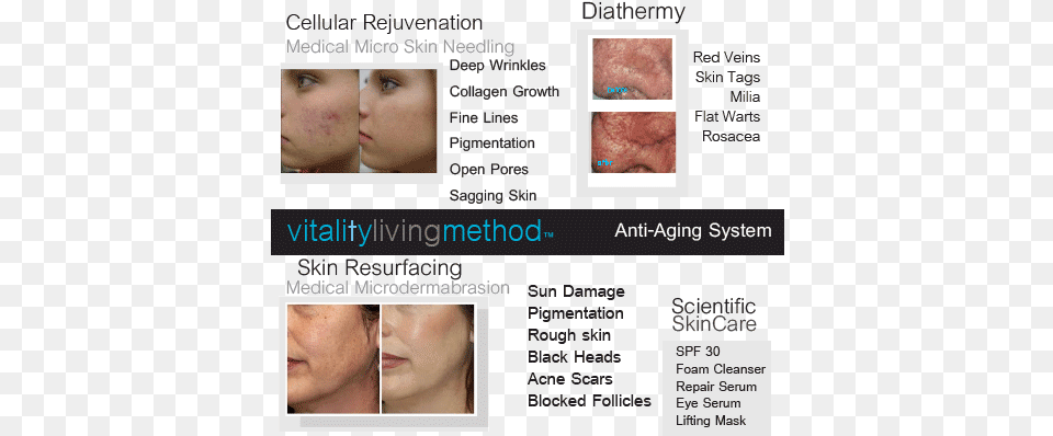 What Is The Best Treatment For Acne Scars Diathermy And Acne, Adult, Person, Neck, Head Png Image