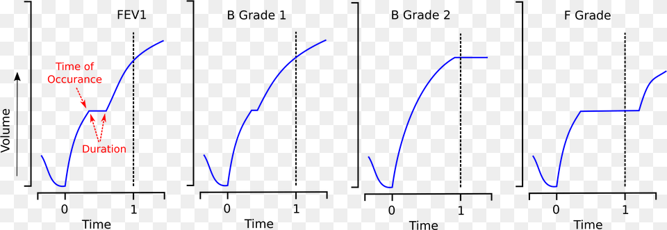 What Matters Is The Duration Of The Pause Within The Diagram, Outdoors Png Image