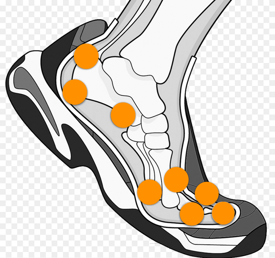 When Should You Pop A Foot Blister, Clothing, Footwear, High Heel, Shoe Free Transparent Png