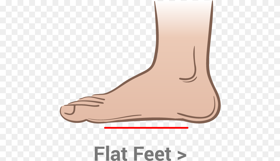 When Your Longitudinal Arch Pronates It Functions Like Flat Feet, Ankle, Body Part, Person, Smoke Pipe Png Image